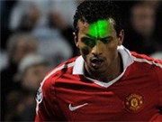 Bóng đá anh, ngoại hạng anh, lịch thi đấu euro 2012, UEFA điều tra vụ chiếu tia laser vào cầu thủ M.U